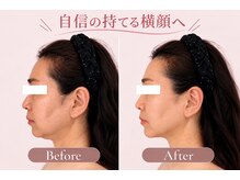 ナースリフェイス(Nurse Reface)の雰囲気（横顔まで美しく！【たるみケア/磐田/小顔】）