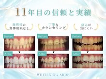 ホワイトニングショップ 広島店(WHITENING SHOP)