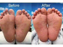 ステイシック(Stay Chic)/フットケア