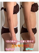 ルミネ(Lumine)/なかなか凹まないお腹周りにぜひ