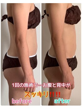 ルミネ(Lumine)/なかなか凹まないお腹周りにぜひ