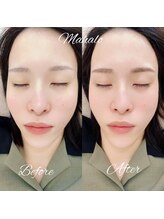 フィーノ(fino.)/左右差改善！