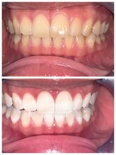 ライトビューティー 池袋店(LightBeauty)/症例写真