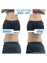 トトノエル 下伊福院/フェムケア