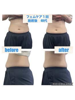 トトノエル 下伊福院/フェムケア