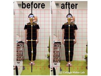 上本町骨盤整体院グッド/「整体による姿勢の変化」