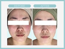 スリムライン 仙台店(The Slim Line)/before→after