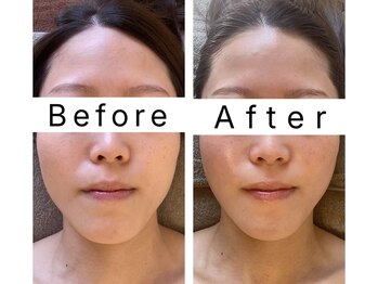 アンシャンテ(Enchant)/周りが変化に気付く！小顔コルギ