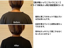 テルケル 佐賀/