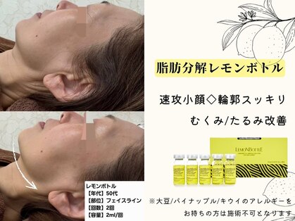 ウェリナ(Welina)の写真