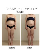 セメ(S'aimer)/インド式デトックスリンパ