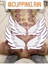 カッピングアンドカッサ専門店 凜(Rin)/凜式カッピング＆カッサ＆高周波