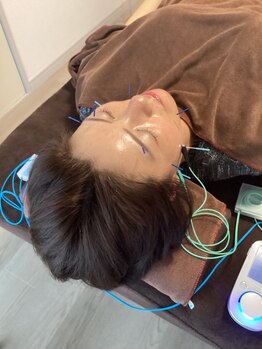 ハリファ鍼灸院 横浜関内院(HariFa鍼灸院)/美容施術 美容鍼