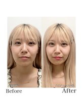 ルネカラー(Renecolor)/フルメイクレッスンBefore/After