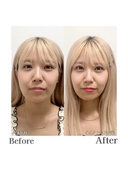 ルネカラー(Renecolor)/フルメイクレッスンBefore/After