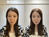 【初回限定！】小顔矯正+美容鍼 ¥12,000→¥6,980 90分