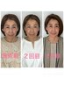 【モニター募集】月1名限定★小顔矯正土台作りコース3回（ヘッド付）