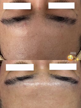 リートライ(Re Try)/プラズマニア