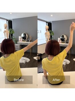 寿 千葉院(KOTOBUKI)/腕が上がらないほどの肩の痛み