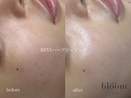 ブルーム(bloom.)の写真
