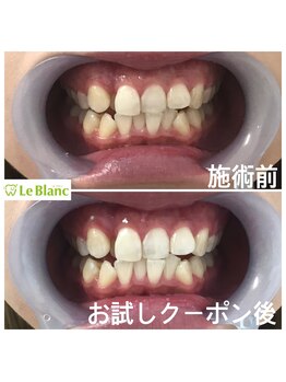ルブラン 奈良店(Le Blanc)/魅力的なお口元を!