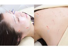 アキュモンド 渋谷院(acumond)の雰囲気（顔～背中までacumond式+微弱電流で内側の不調を徹底的に施術）