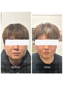 ダンニヒル(dannihil)/小顔矯正