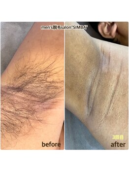 メンズ シンバ(SIMBA)/◯before→after◯