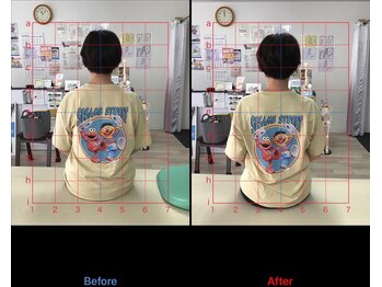 ストレチックス 近江八幡店/before/after