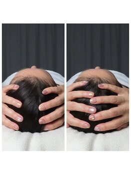 パシト(pasito)/脳洗浄小顔ヘッドマッサージ