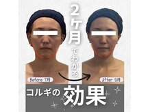 小顔フェイスラボ キュテラ 藤が丘店(小顔 Face Labo. Cutella)の雰囲気（たった2か月で、痩せた？って言われるくらいの変化を実感♪）