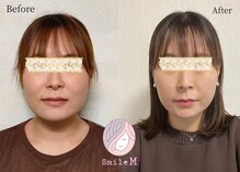 スマイルエム(SmileM)