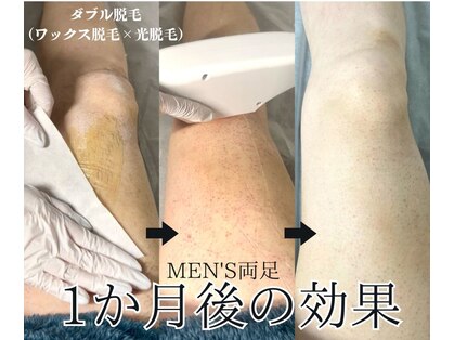 ミルダ(MIRUDA)の写真