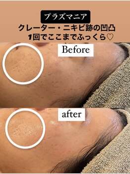 ビューティーネイル(Beauty Nail)/プラズマニア