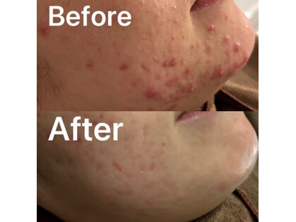 ハイコガオ 中崎町店(HIKOGAO)の写真