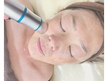 【毛穴・シミ改善・ニキビケア】フェイシャルも叶うトータルケア