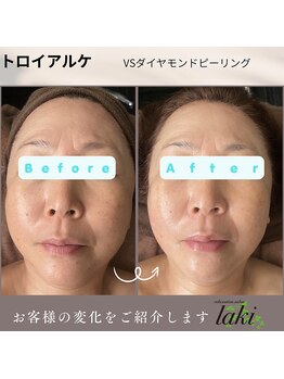 リラクゼーションサロン ラキ(laki)/芸能人が受けているヒーリング
