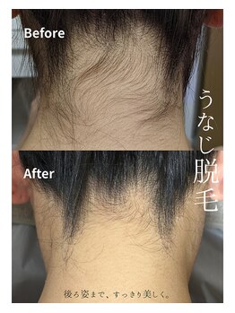 サロンドダリア(Salon de Dahlia)の写真/【4回目まで初回価格】バイマッハのイオン導入IPL全身脱毛◎納得の効果で毛穴レスなツヤツヤ美肌へ導く！