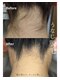 サロンドダリア(Salon de Dahlia)の写真/【4回目まで初回価格】バイマッハのイオン導入IPL全身脱毛◎納得の効果で毛穴レスなツヤツヤ美肌へ導く！