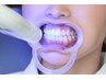 【歯を自然な白さへ】セルフホワイトニング（照射:10分×2回)¥2,640