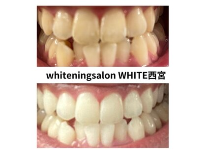 Whitening Salon WHITE 西宮店