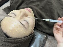 ミランオオサカ(MIRAN OSAKA)/水光肌改善ピールで韓国肌に！！