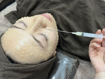 ミランオオサカ(MIRAN OSAKA)/水光肌改善ピールで韓国肌に！！