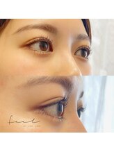 フィール(feel)/メーテルロット