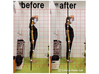 上本町骨盤整体院グッド/「整体による姿勢の変化」