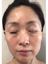 ビューティーメイクさくら/