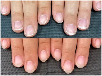 ライム(Lime)の写真/もう爪を隠さなくても良い/お爪の悩みのある方のための自爪育成メニューで美爪へ♪