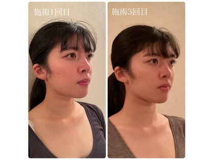 アリス(Alice)の写真