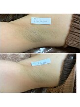 プリマ 栄店(Prima)/BEFORE&AFTER