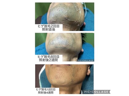 リバティー(Liberty)の写真